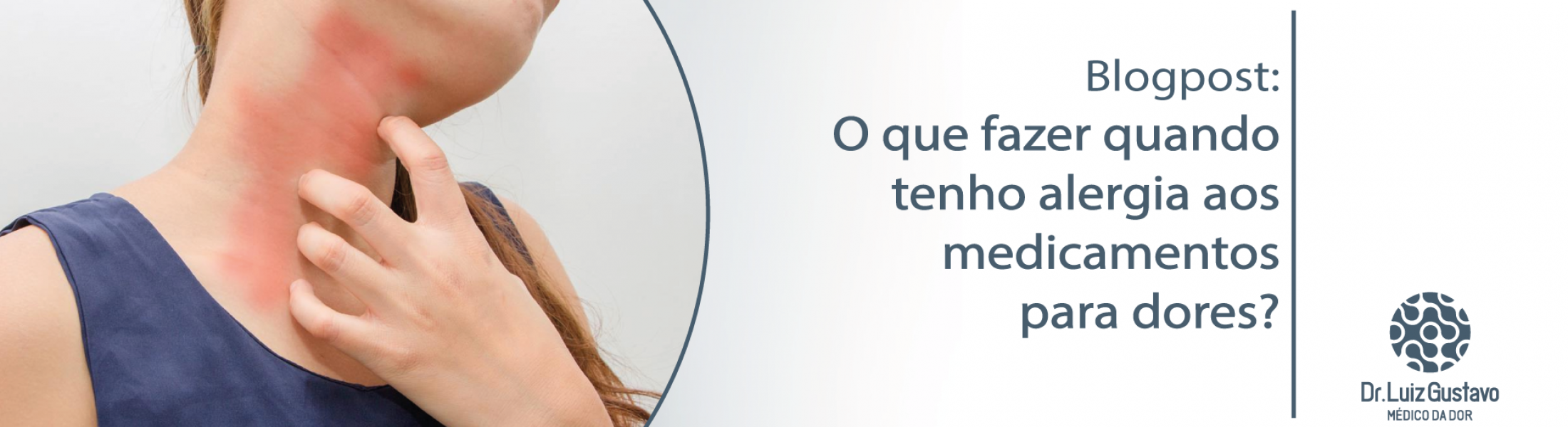 O que fazer quando tenho alergia aos medicamentos para dores? – Dr ...